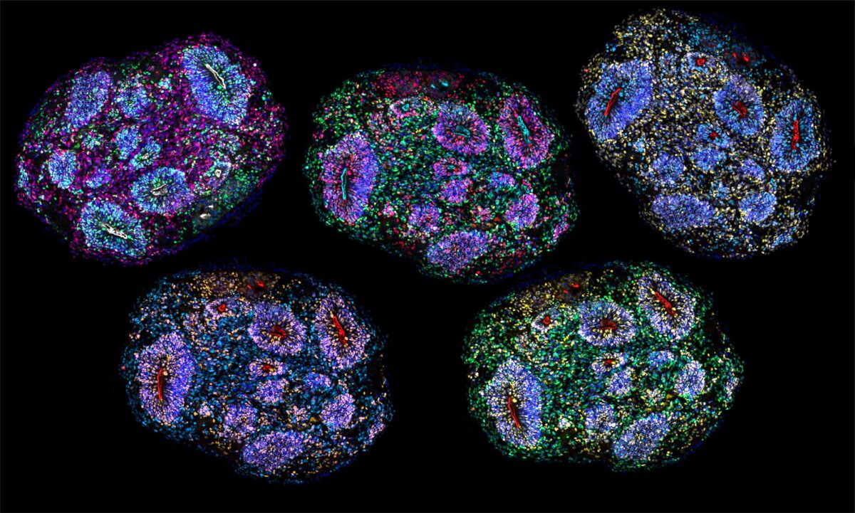 Revolución en neuromedicina al lograr minicerebros humanos que se mantienen vivos durante años
