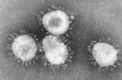 Cuatro coronavirus observados por un microscopio