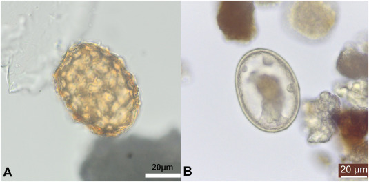 A) Huevo de Ascaris sp. con pelaje mamillado B) Huevo decorticado de Ascaris sp.